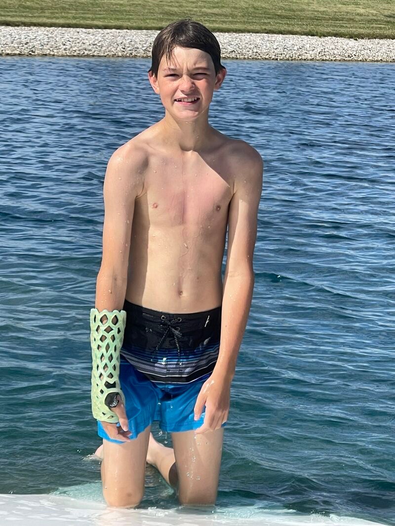 A boy standing in a lake wearing a green FlexiOH arm cast